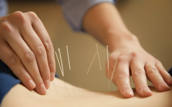 acupuncturist